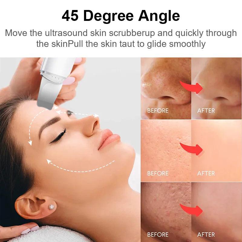 Ultrasonic Facial Enhancer - Shop Express